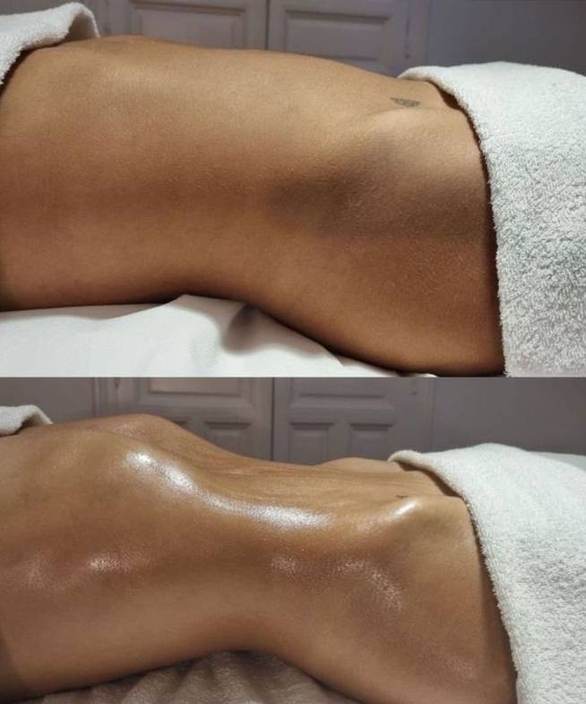 Violeta Mangriñán y el antes y después de su masaje drenante.