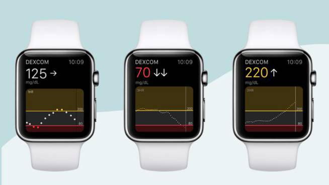 El smartwatch para diabéticos.