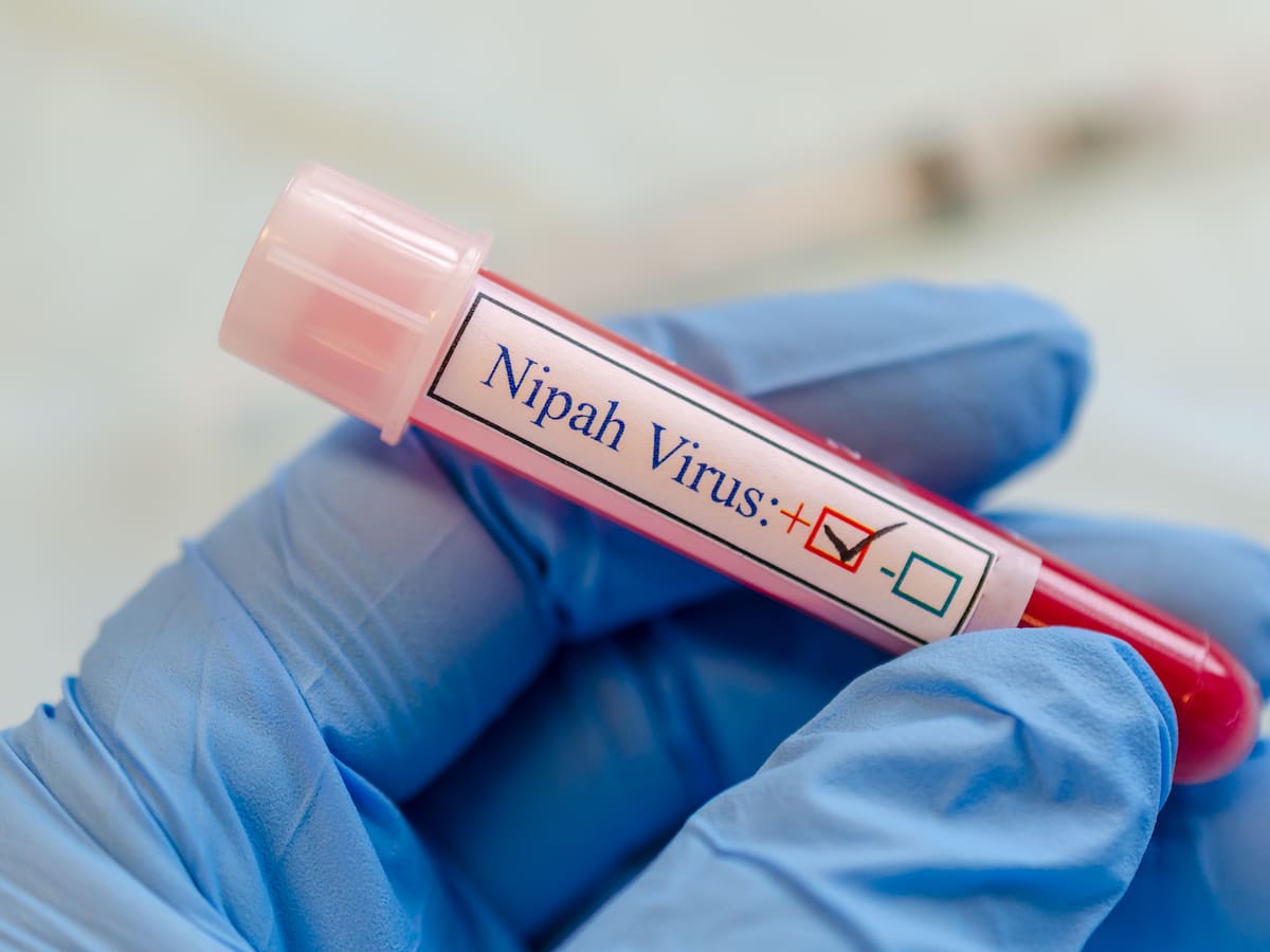 Alerta en India por un nuevo brote del virus Nipah: qué es, síntomas y por qué preocupa a la OMS