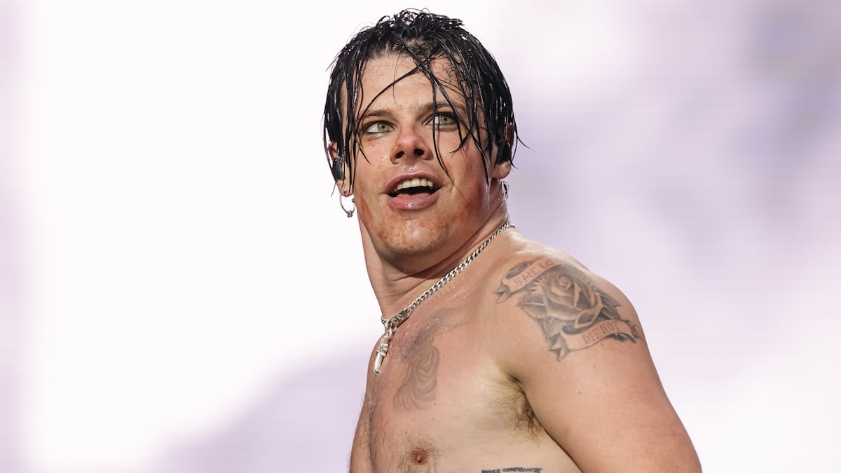 Yungblud se rompe una pierna en un accidente de moto y toma una decisión sobre sus conciertos