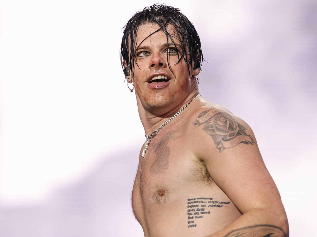 Yungblud se rompe una pierna en un accidente de moto y toma una decisión sobre sus conciertos