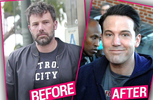 ¿Qué le pasó en la cara a Ben Affleck?