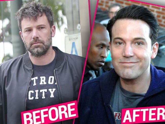 ¿Qué le pasó en la cara a Ben Affleck?