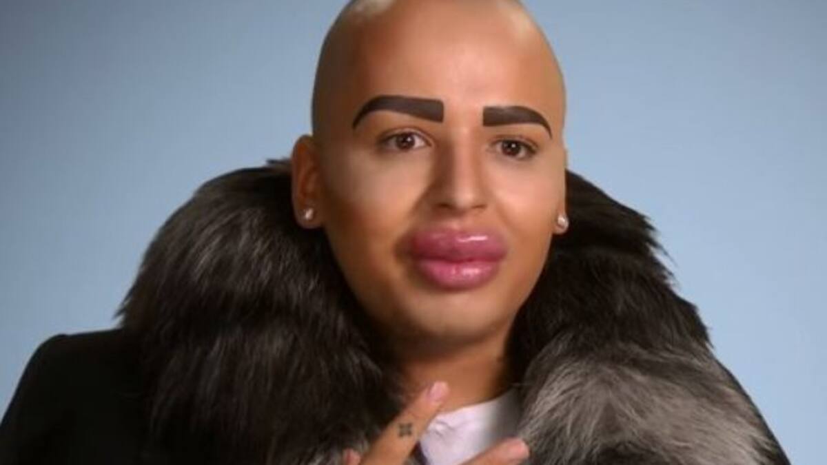 Así es Botched, el reality de la gente que se ha pasado con la cirugía