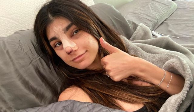 Mia Khalifa primer día después de su cirugía