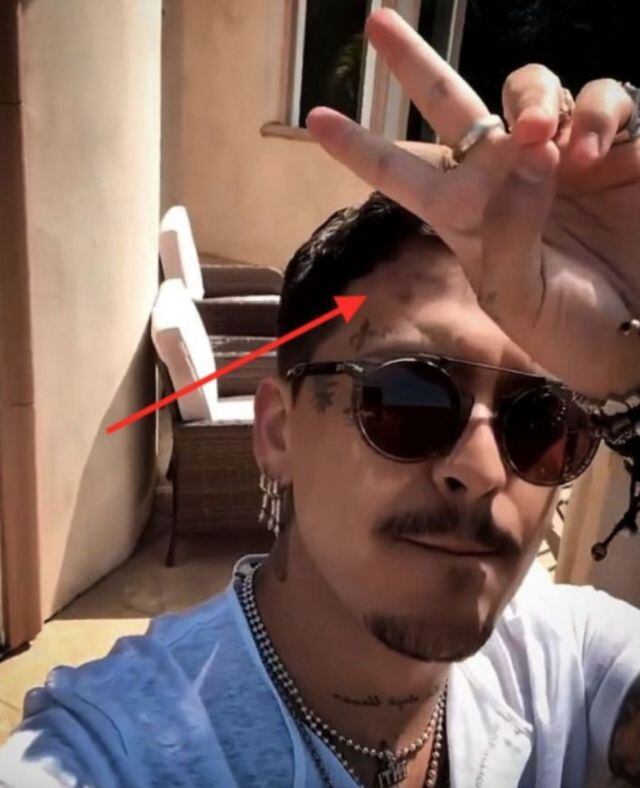 Christian Nodal ha ido borrado sus tatuajes poco a poco