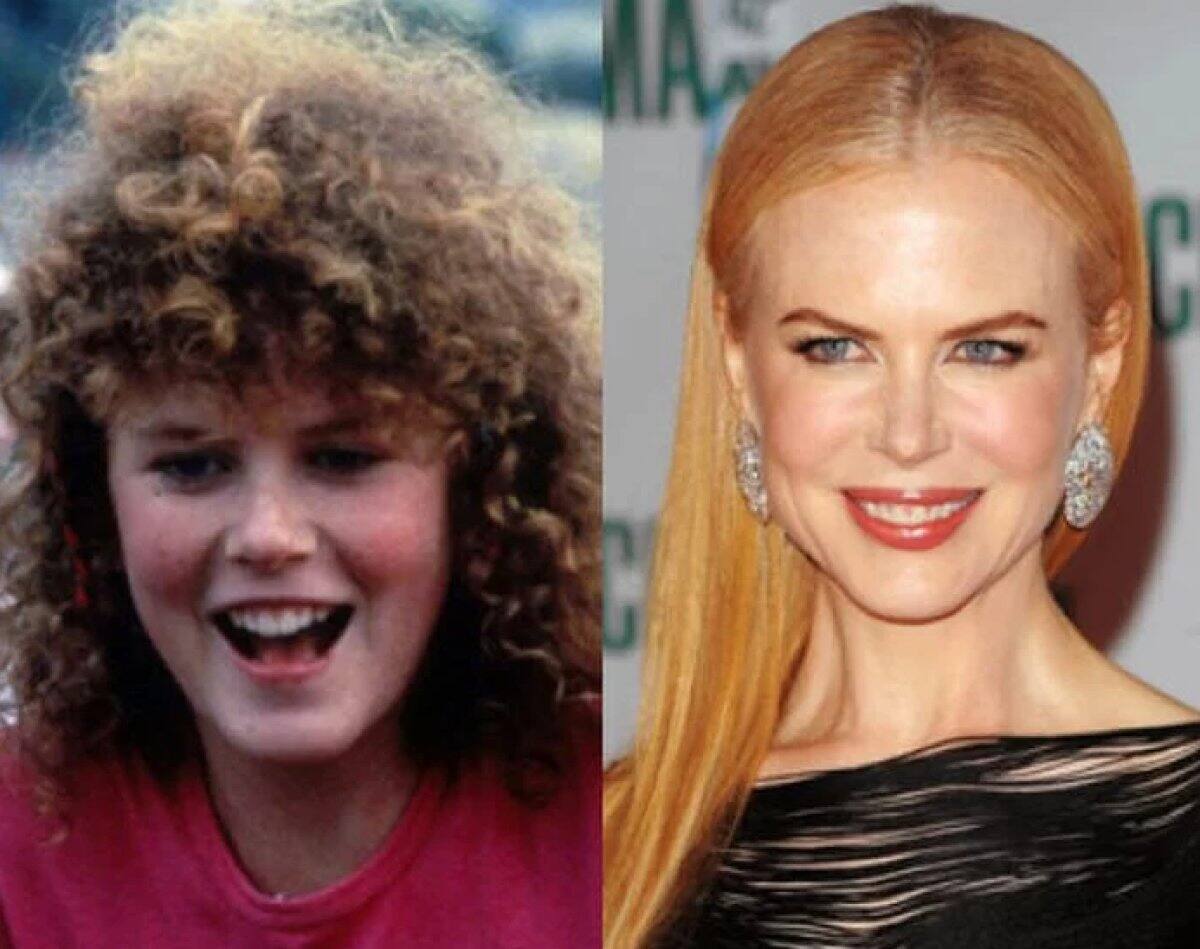 Nicole Kidman