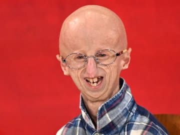 Muere a los 28 años Sammy Basso, la persona con progeria de Hutchinson-Gilford más longeva