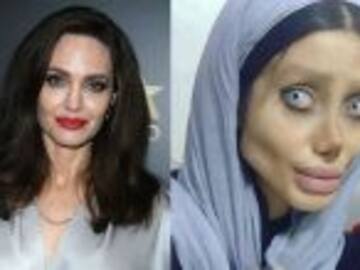 Se hizo 50 cirugías para parecerse a Angelina Jolie, el resultado, catastrófico