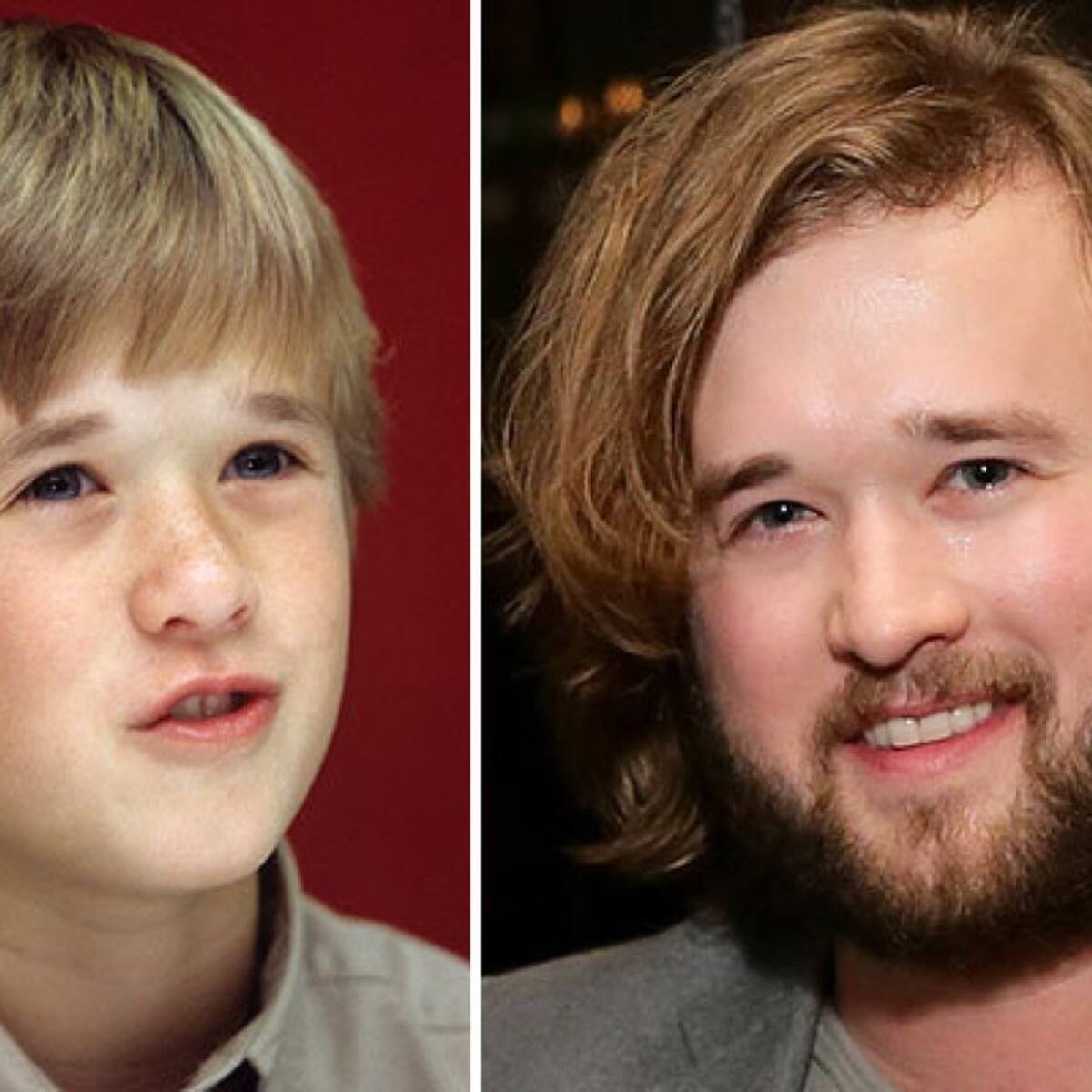 Mirá a las celebrities antes y después