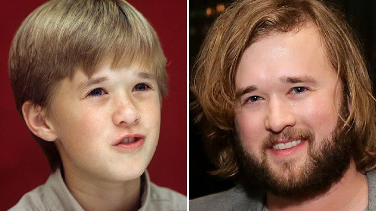 Mirá a las celebrities antes y después