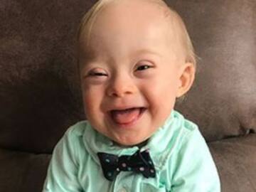 Marca de papillas presenta a su primer bebé con síndrome de Down