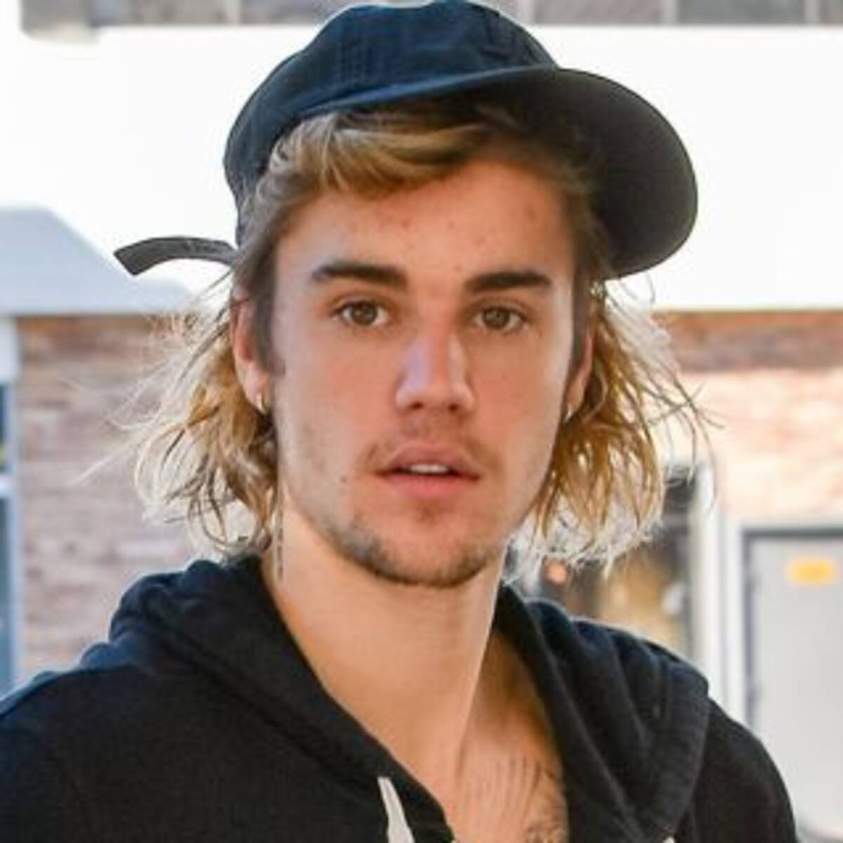 ¿Qué es Lyme, la enfermedad que padece Justin Bieber?