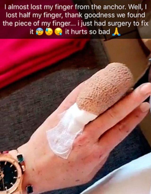 ¡Lindsay Lohan perdió un dedo!