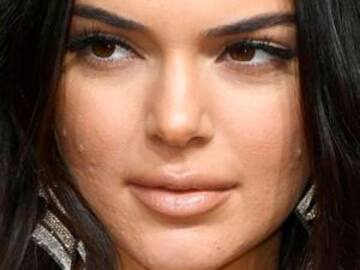 Kendall Jenner responde a críticas sobre su acné