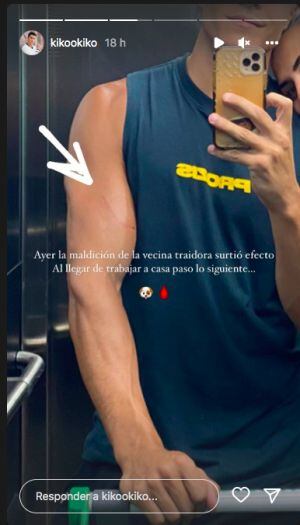 Kiko Jiménez a través de su Instagram Stories