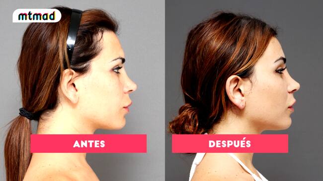Daniela Requena mostrando su cambio en el rostro.