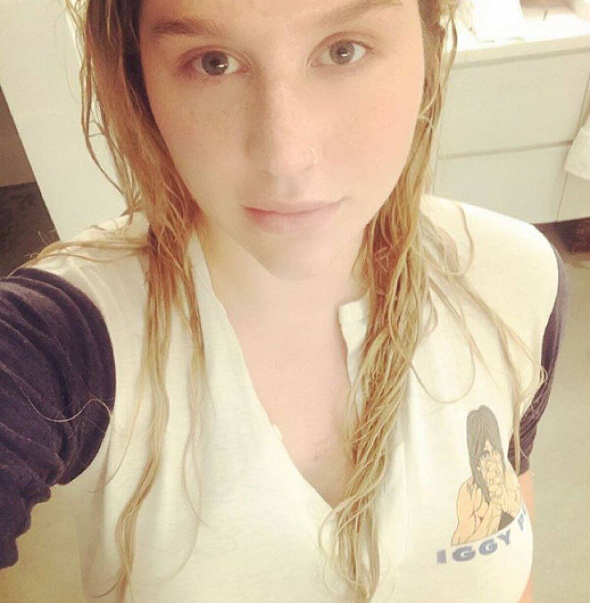 Kesha