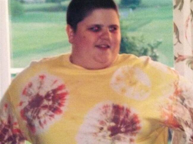 Austin Shifflet cuando tenía sobrepeso.