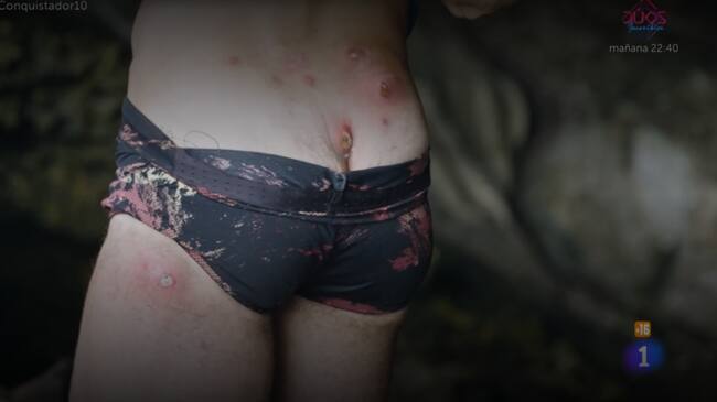 Heridas de Loren, en 'El Conquistador'