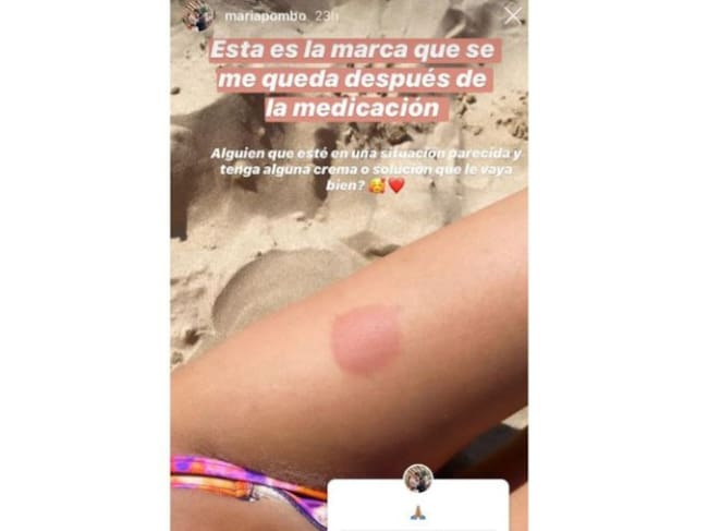 María Pombo muestra los efectos secundarios