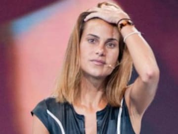 La cara de Carla Barber antes y después de todas sus operaciones