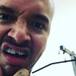 J Balvin se rompió un diente y las redes enloquecieron