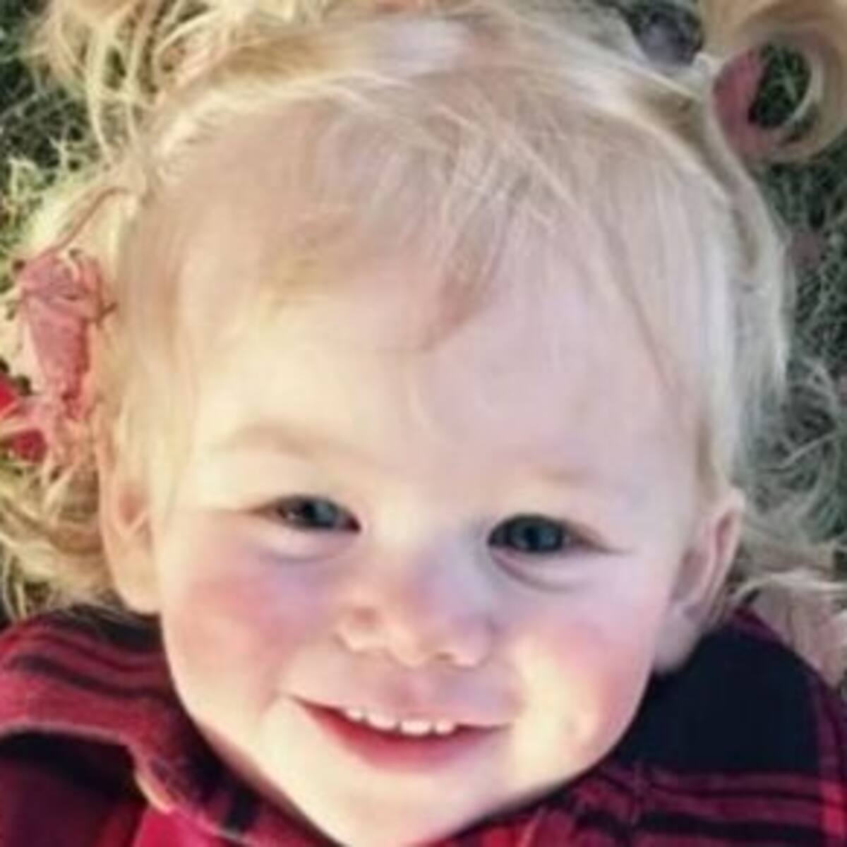 Niña de un año es alérgica a sus propias lágrimas