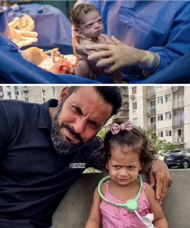Bebé que nació enojada recrea la foto con el fotógrafo que la retrató