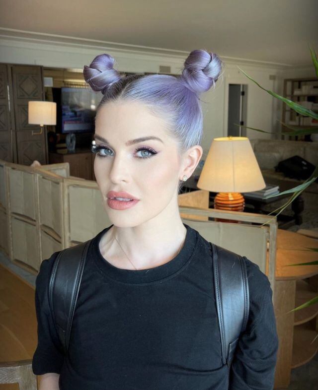 Rostro de Kelly Osbourne cambió drásticamente