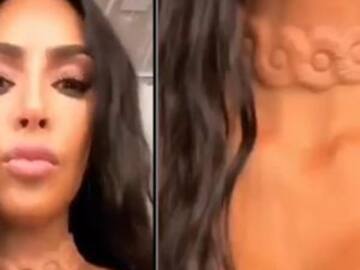El collar implantado en el cuello de Kim Kardashian