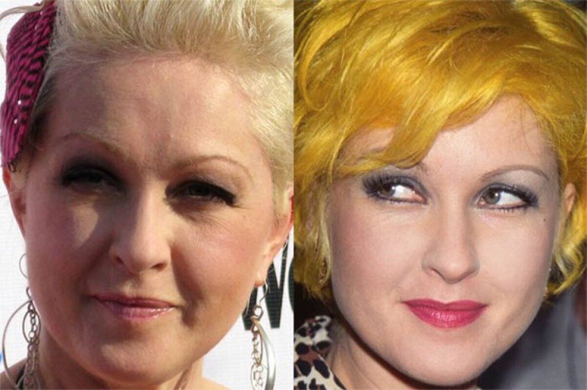 Cyndi Lauper - La exitosa cantante tuvo una etapa muy dura de su vida en la que trabajó como mesera.