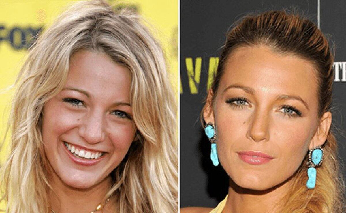 Blake Lively