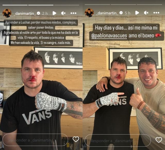 Dani Martín en sus stories de Instagram