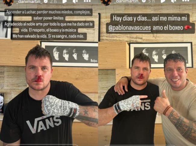 Dani Martín en sus stories de Instagram