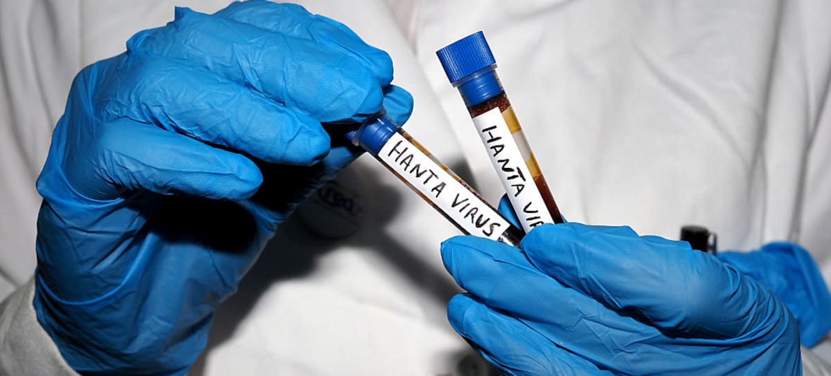El hantavirus ha puesto en alerta a la comunidad internacional.