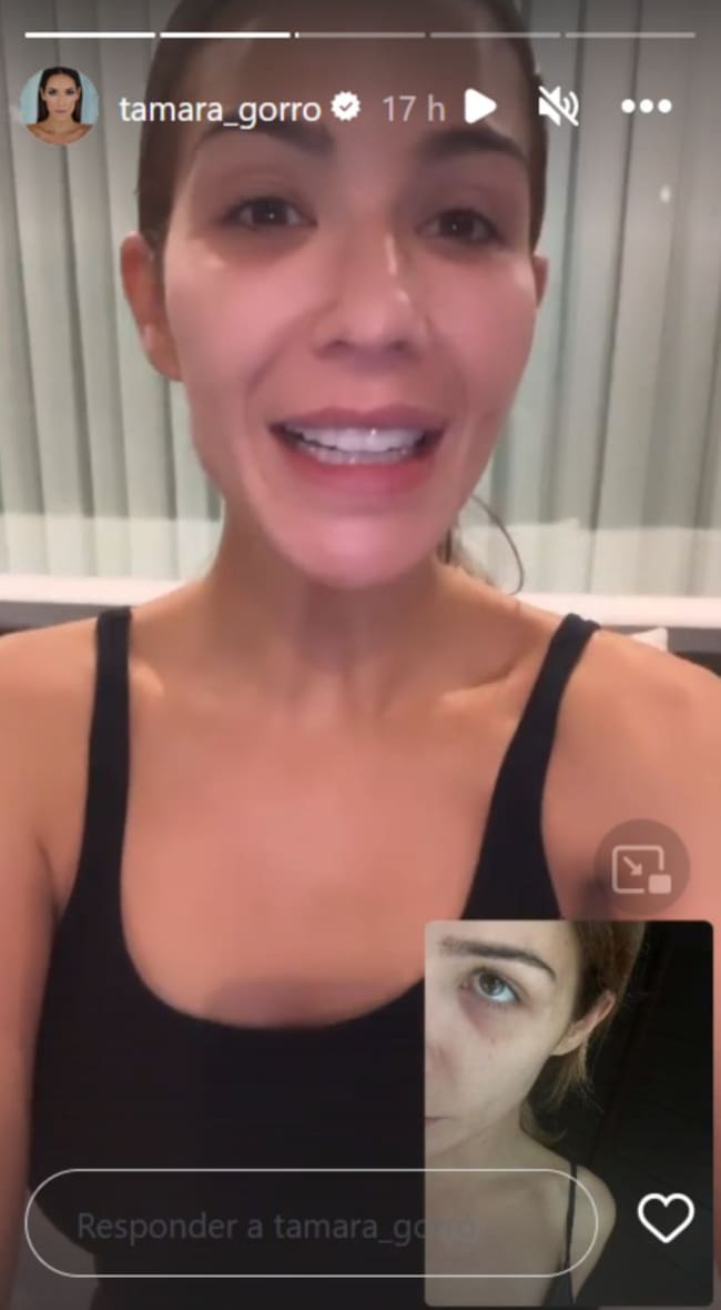 Tamara Gorro muestra sus ojeras.