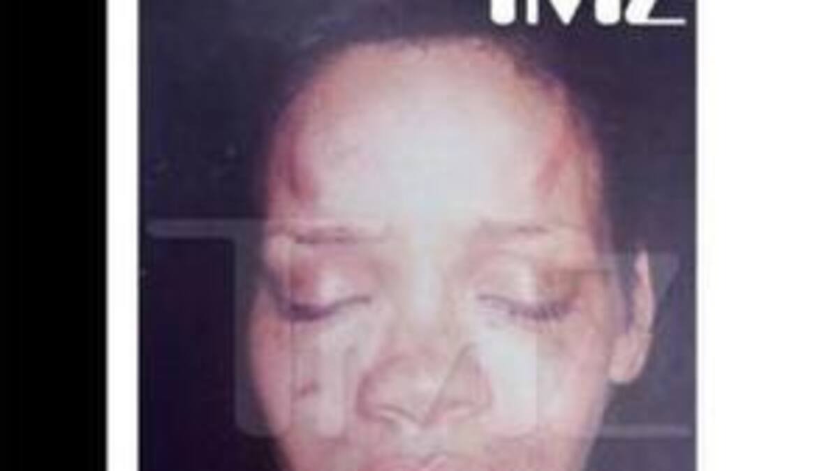Aparece en Internet una foto del rostro golpeado de Rihanna