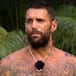 Albert Barranco se enfrenta a la decisión médica tras ser evacuado en ‘Supervivientes All Stars’