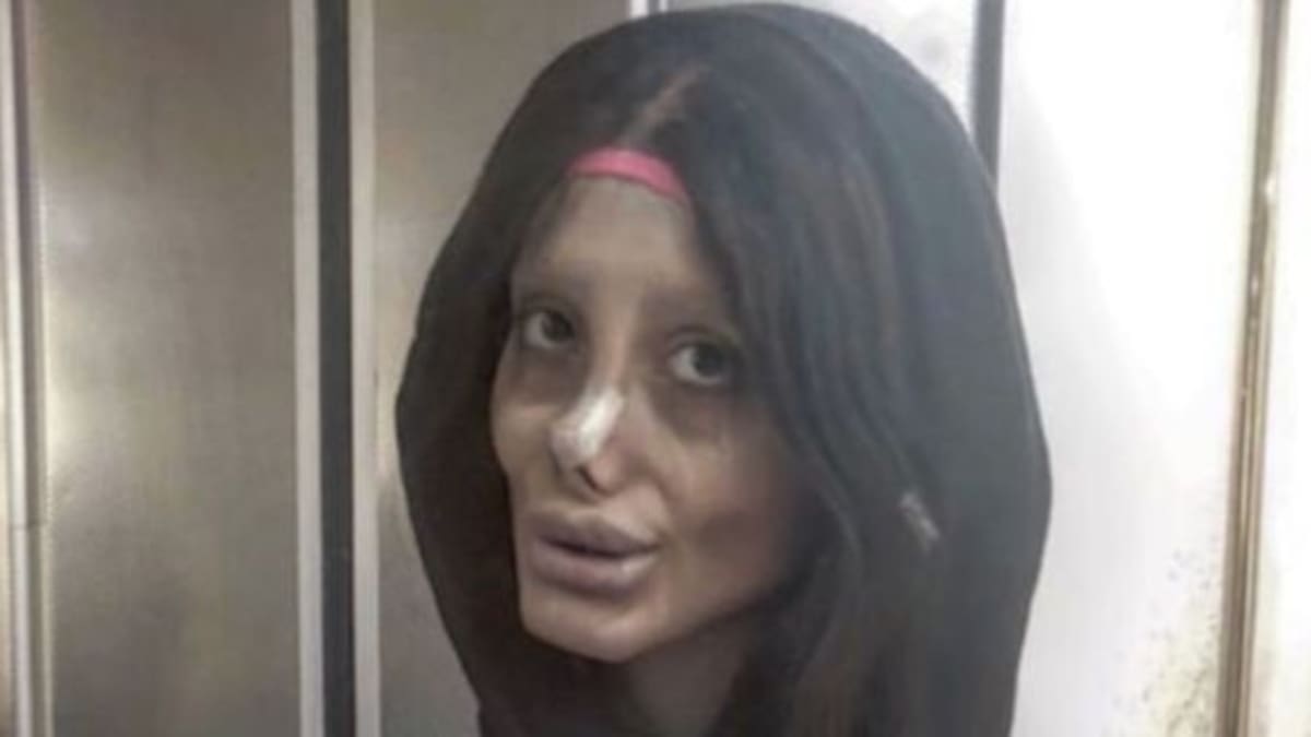 La mujer que se hizo 50 cirugías para parecerse a Angelina Jolie