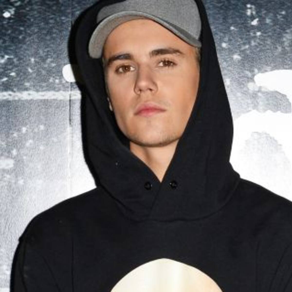 ¿Qué le pasó en el pecho a Justin Bieber?