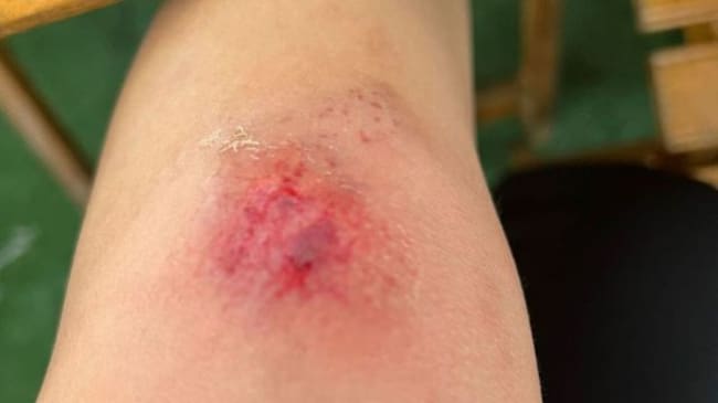 Lucía Sánchez se hace daño en la rodilla.