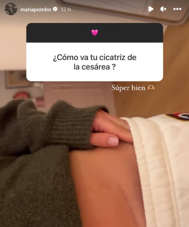 María Pombo enseña su cicatriz de la cesárea en Instagram