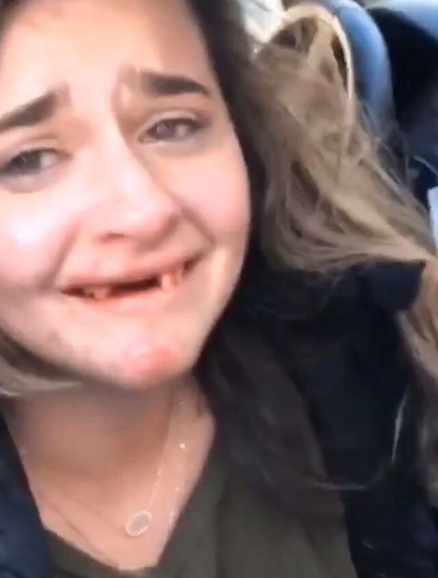 Video viral: Perdió los dientes por reto de TikTok