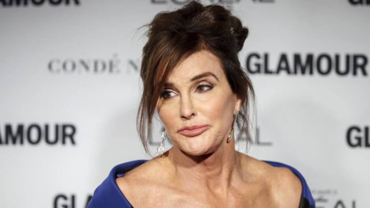 Caitlyn Jenner se está quedando calva