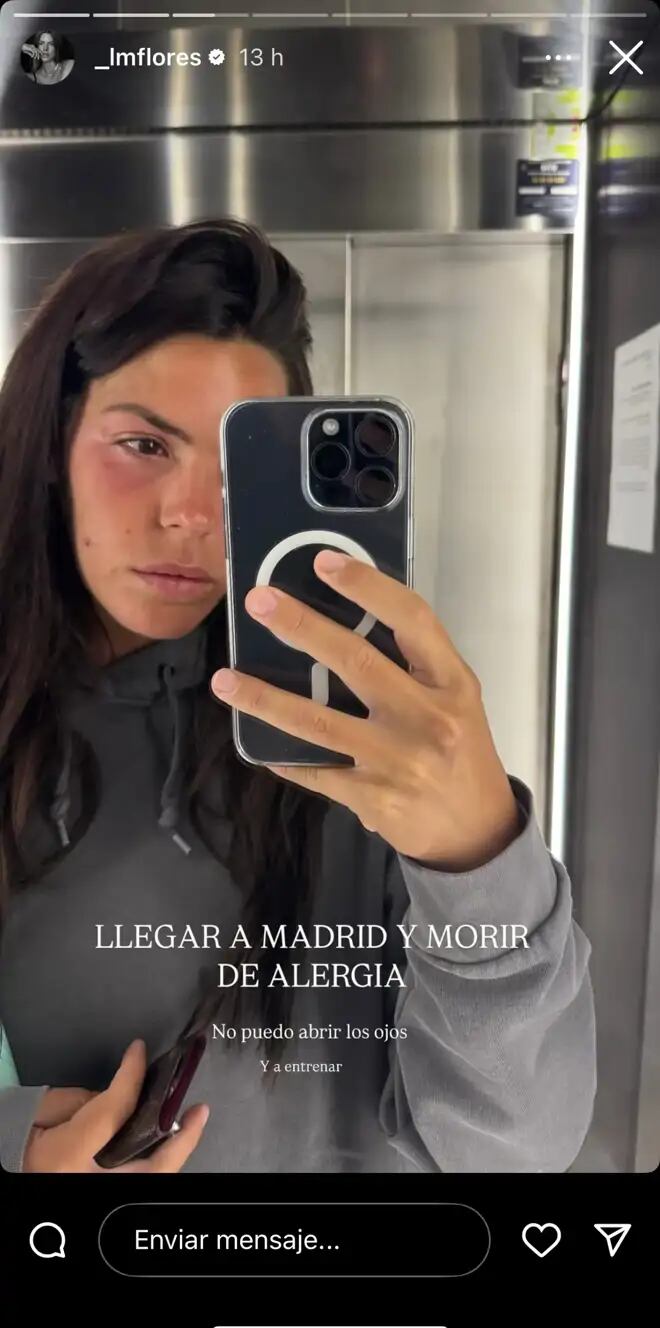 Laura Matamoros con alergia en su Instagram