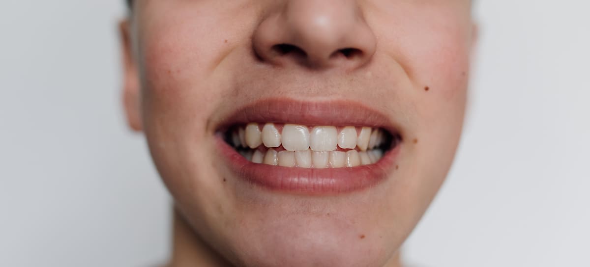 Una mujer muestra sus dientes