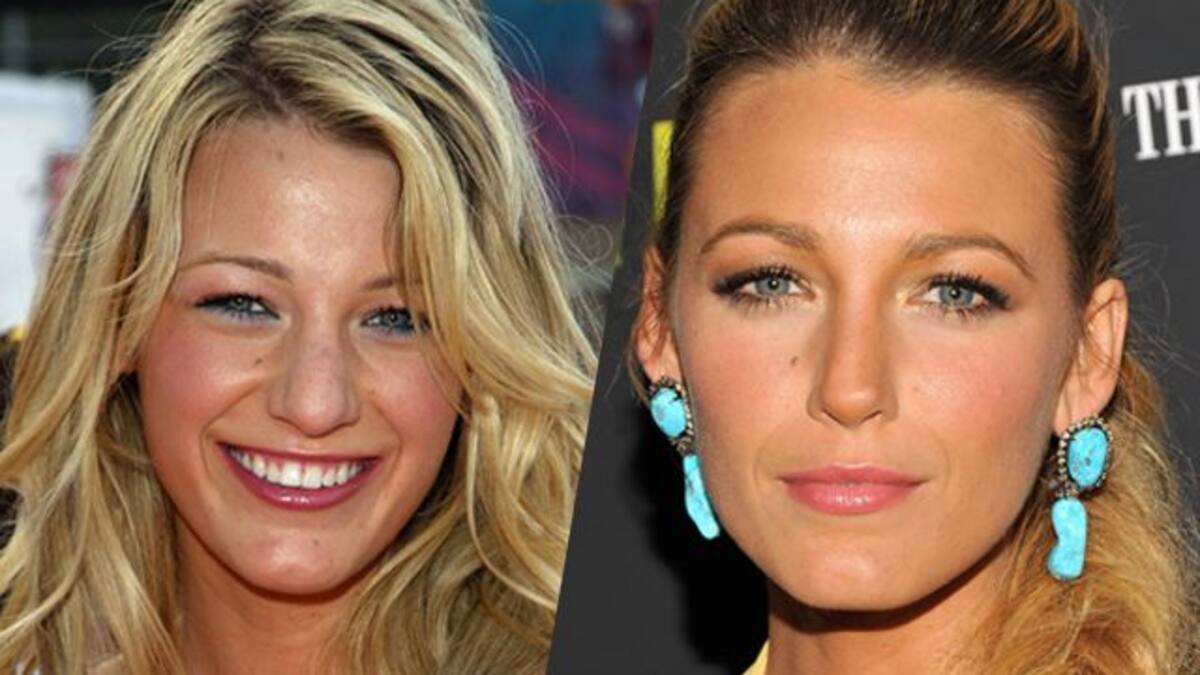 10 celebrities que se retocaron la nariz