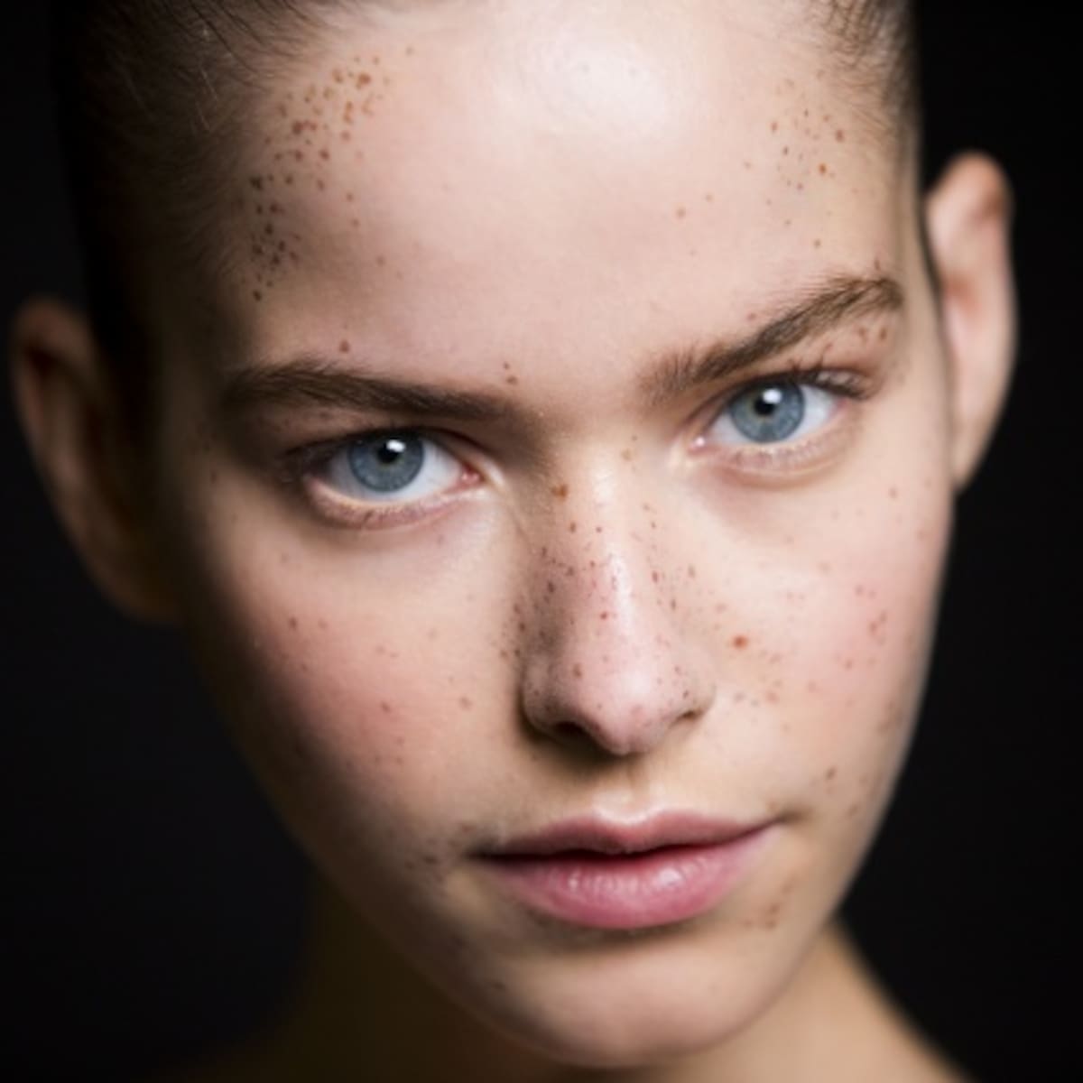 ¿Estarían dispuestos a hacer el "Freckling"?