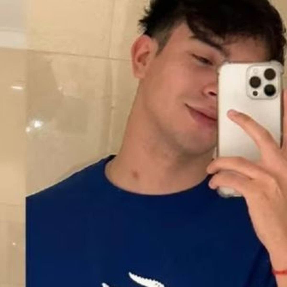 Rusherking aclaró sobre la marca en su cuello: "No es un chupón"